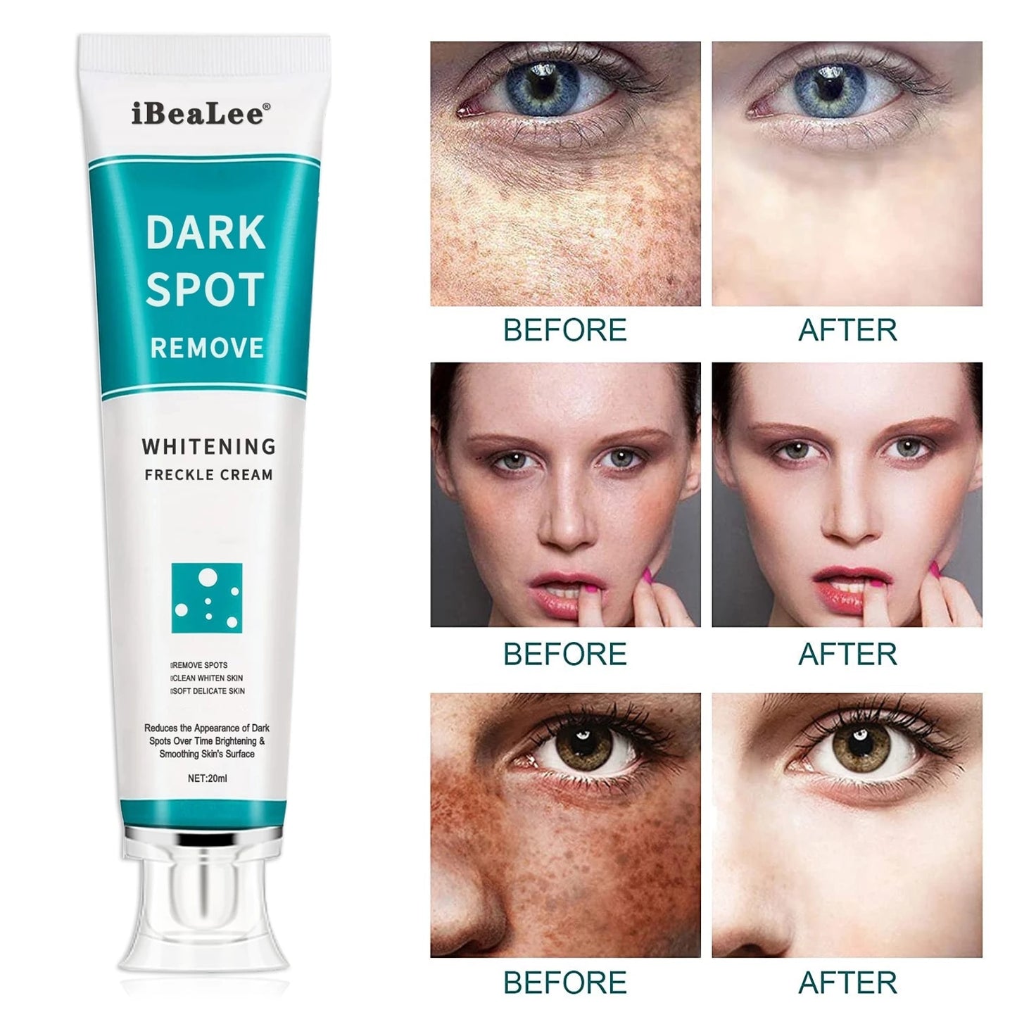 Whitening Freckle Cream Remove Melasma