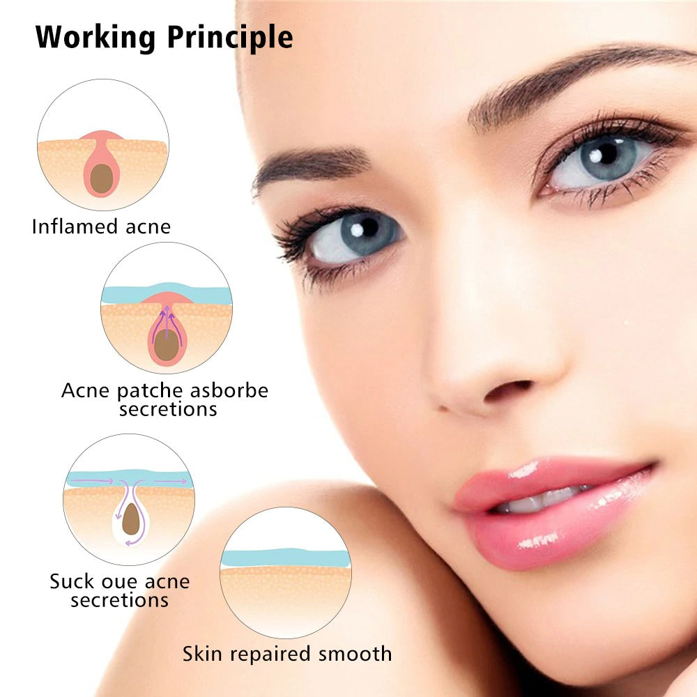 Face Acne Pimple Master Patch Anti Infection Spot