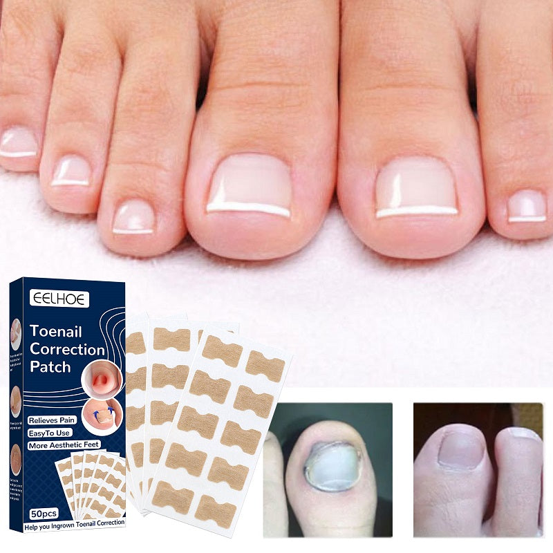 Nail Correction Stickers Ingrown